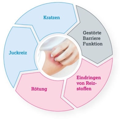 Bild gesunde Haut und Haut mit Neurodermitis